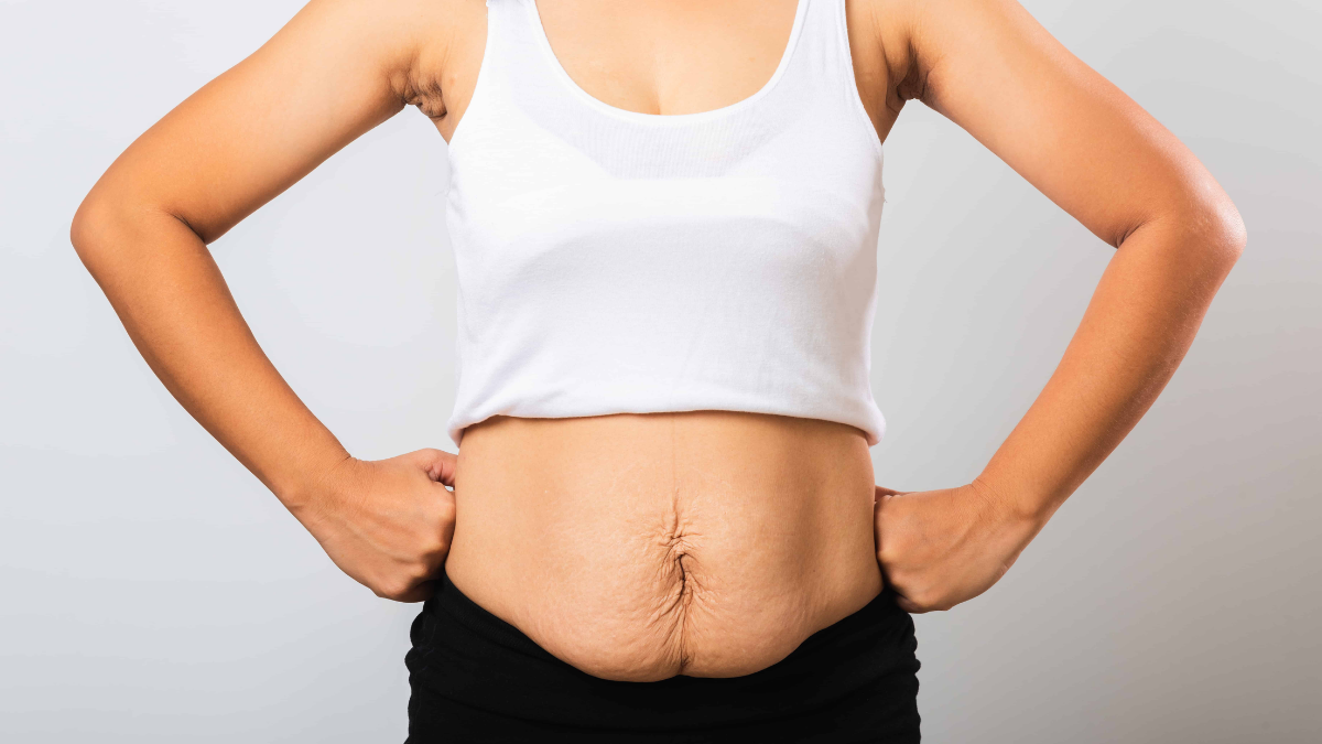 pregnancy weight loss